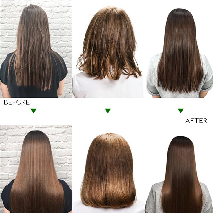 Anti-Hair Loss Shampoo Hair Loss Treatments Every Day And Night 