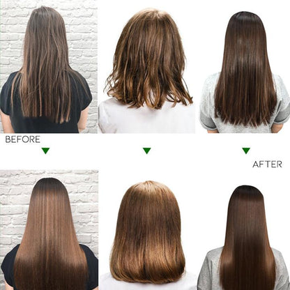 Anti-Hair Loss Shampoo Hair Loss Treatments Every Day And Night 